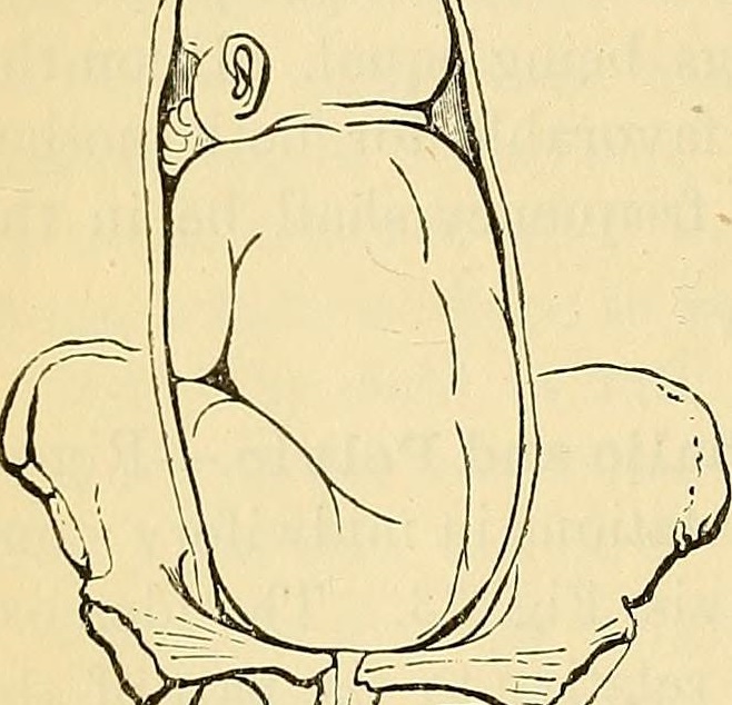 Выбирает ли ребенок, как ему родиться?